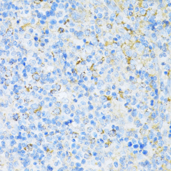 Anti-VAMP1 Polyclonal Antibody (CAB8877)