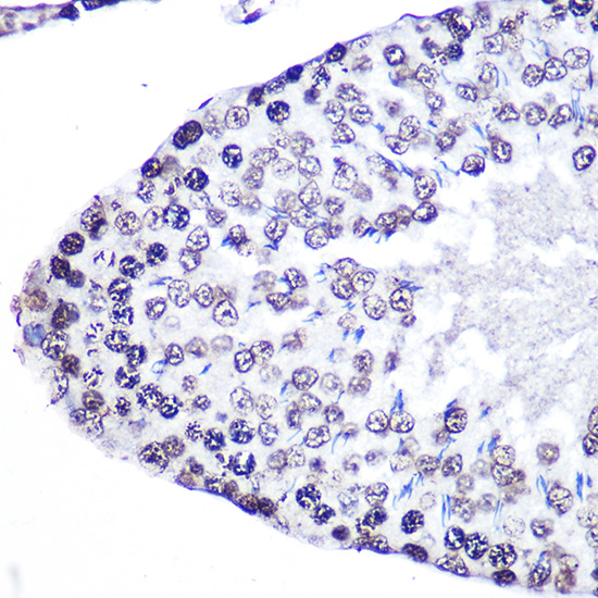 Anti-Phospho-ERK1-T202/Y204 + ERK2-T185/Y187 Antibody (CABP0472)