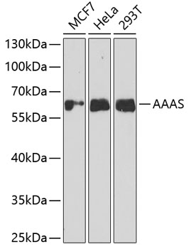 Anti-AAAS Antibody (CAB6427)