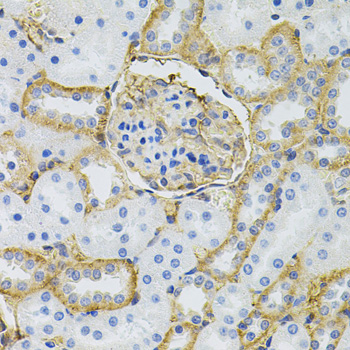 Anti-SLC6A1 Antibody (CAB7730)