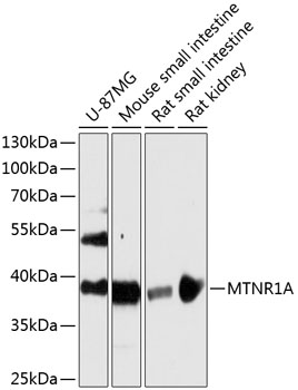 Anti-MTNR1A Antibody (CAB13030)