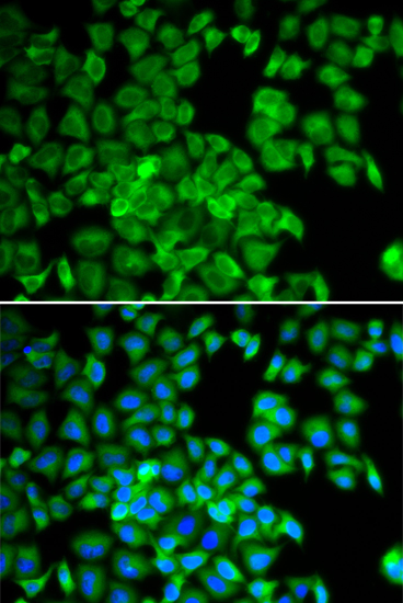 Anti-TCP1 Antibody (CAB13364)