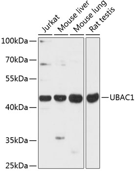 Anti-UBAC1 Antibody (CAB13071)