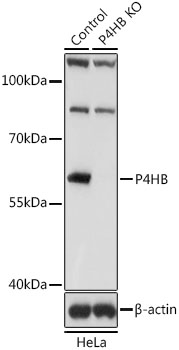 Anti-P4HB Antibody [KO Validated] (CAB0692)