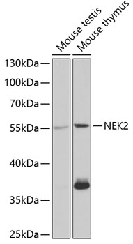 Anti-NEK2 Antibody (CAB5355)