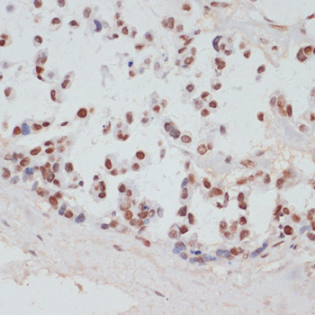 Anti-Phospho-RPS6KA5-S376 pAb (CABP0800)