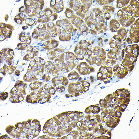 Anti-RPS14 Antibody (CAB6727)