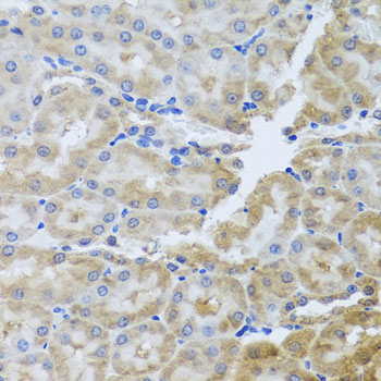 Anti-PER1 Polyclonal Antibody (CAB8449)