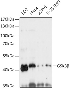 Anti-GSK3Beta Antibody [KO Validated] (CAB6164)