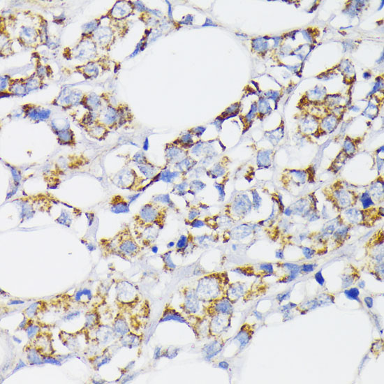 Anti-USP33 Antibody (CAB16187)