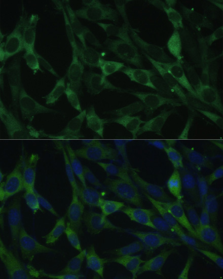 Anti-CALU Antibody (CAB6538)