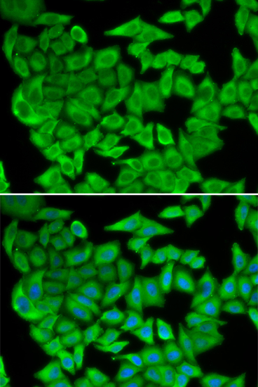 Anti-MDH2 Antibody (CAB13516)