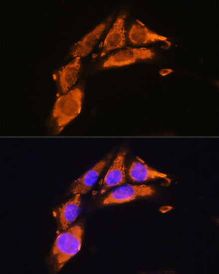 Anti-AGRN Antibody (CAB17320)