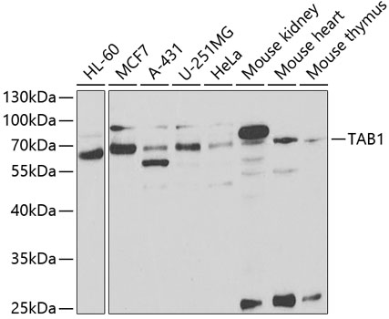 Anti-TAB1 Antibody (CAB5749)