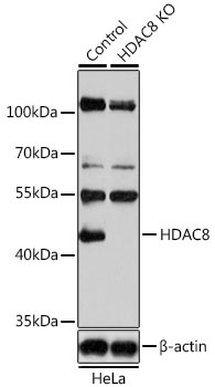 Anti-HDAC8 Antibody [KO Validated] (CAB5829)