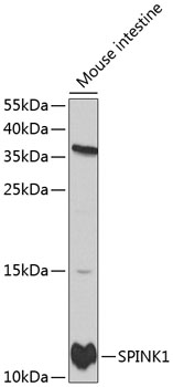 Anti-SPINK1 Antibody (CAB1096)