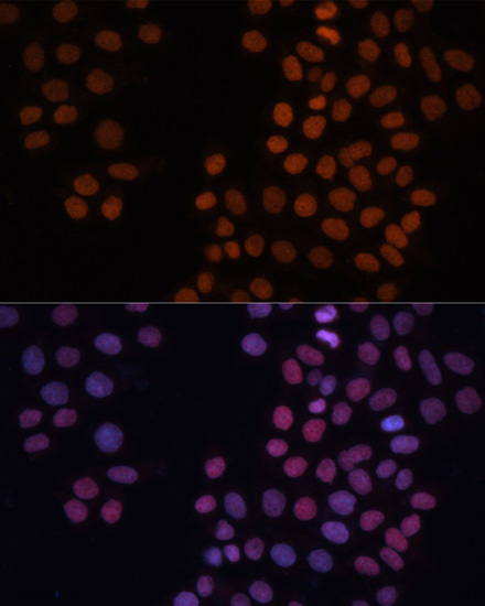 Anti-HMGN1 Antibody (CAB6155)