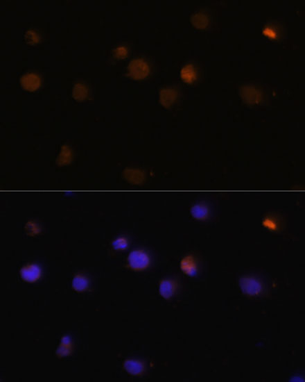 Anti-RB Antibody (CAB11409)