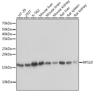 Anti-RPS19 Antibody (CAB3675)