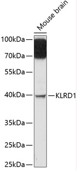 Anti-KLRD1 Antibody (CAB12698)