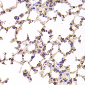 Anti-TSC22D3 Antibody (CAB6779)