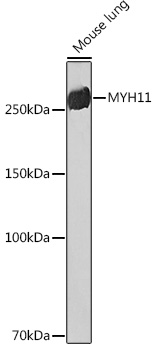 Anti-MYH11 Antibody (CAB4064)