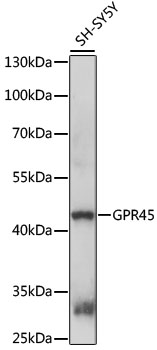 Anti-GPR45 Antibody (CAB15790)