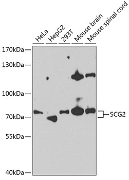 Anti-SCG2 Antibody (CAB13563)