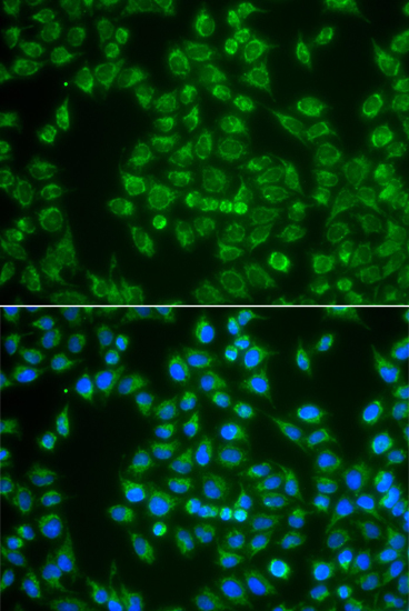 Anti-MAP4K3 Antibody (CAB13375)