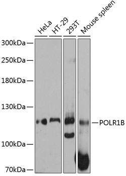 Anti-POLR1B Antibody (CAB12034)