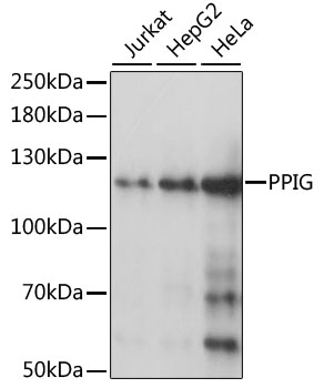 Anti-PPIG Antibody (CAB0429)