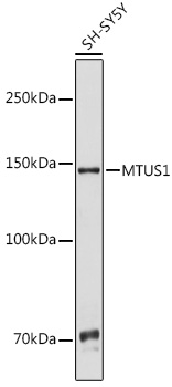 Anti-MTUS1 Antibody (CAB13437)