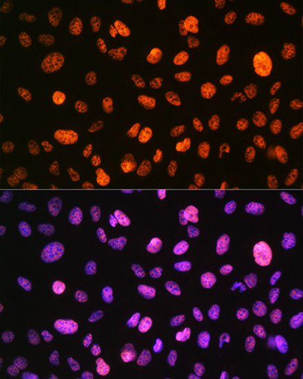 Anti-Phospho-Histone H3-S10 pAb (CABP0840)