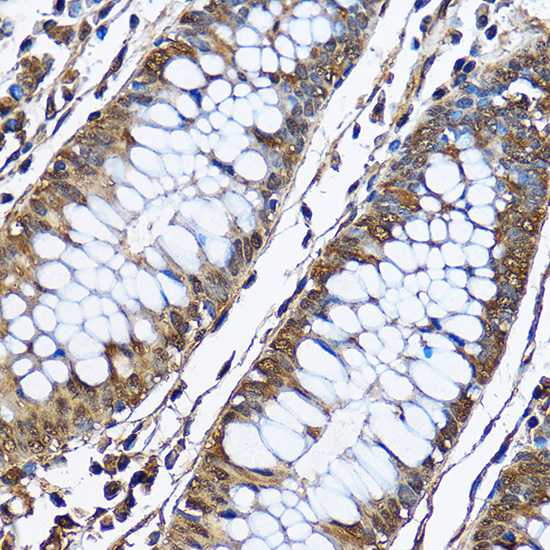 Anti-PHD2 Antibody [KO Validated] (CAB14557)