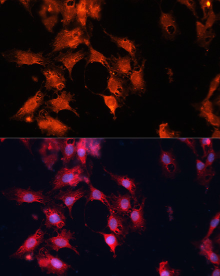 Anti-DNAJA3 Antibody (CAB13386)