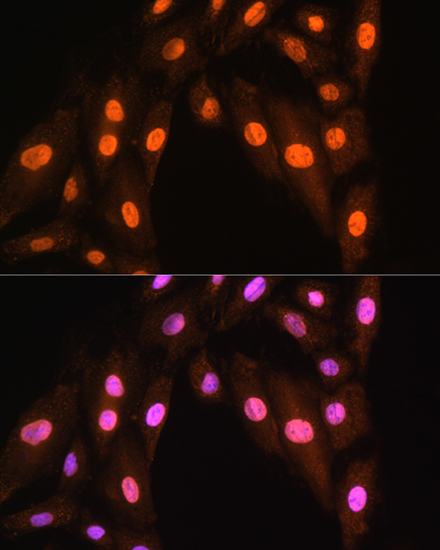 Anti-BRMS1 Antibody (CAB14865)