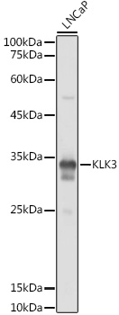 Anti-KLK3 Antibody (CAB2052)