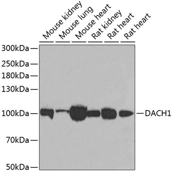 Anti-DACH1 Antibody (CAB6895)