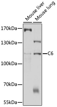 Anti-C6 Antibody (CAB10170)