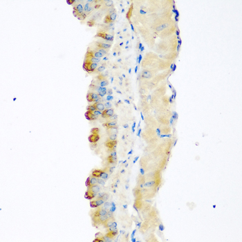 Anti-MSTN Antibody (CAB6913)