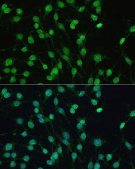 Anti-PXR Antibody (CAB17038)