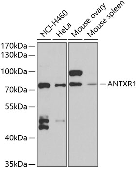 Anti-ANTXR1 Antibody (CAB6525)