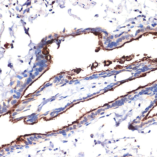 Anti-MUC1 Antibody (CAB0333)