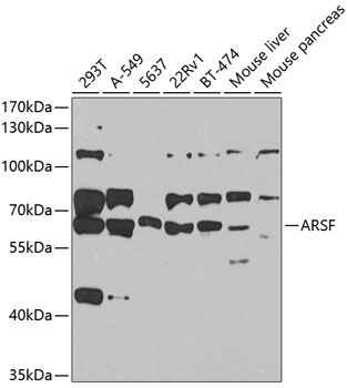 Anti-Arylsulfatase F Polyclonal Antibody (CAB8102)