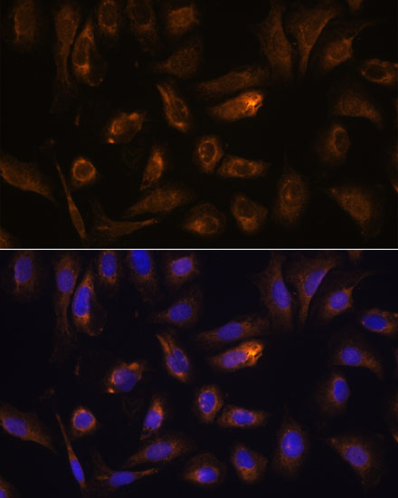 Anti-RGS4 Antibody (CAB1787)