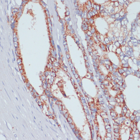 Anti-SLC39A4 Antibody (CAB3454)