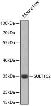 Anti-SULT1C2 Polyclonal Antibody (CAB8154)