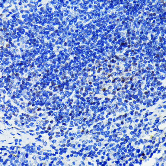 Anti-PARP Antibody [KO Validated] (CAB19596)