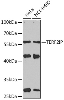 Anti-TERF2IP Antibody (CAB15163)