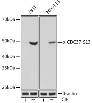 Anti-Phospho-CDC37-S13 Antibody (CABP1141)